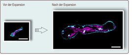 Keimschlauch von Aspergillus fumigatus vor und nach der Expansion zu sehen; Maßstab = 10 Mikrometer