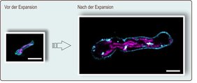 Keimschlauch von Aspergillus fumigatus vor und nach der Expansion zu sehen; Maßstab = 10 Mikrometer
