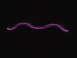 Das photosynthetische Bakterium Rhodospirillum rubrum 