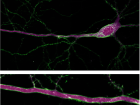 ‚sDarken‘ Serotonin