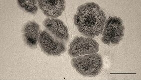 Elektronenmikroskopische Aufnahme des Acidobakteriums KBS 83