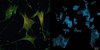 CD44 (grün) aktiviert krebsassoziierte Fibroblasten. Wird das Molekül ausgeschaltet (rechts), verändern die Zellen ihre Form und verlieren ihre Aktivierung. CD44 (grün) aktiviert krebsassoziierte Fibroblasten. Wird das Molekül ausgeschaltet (rechts), verändern die Zellen ihre Form und verlieren ihre Aktivierung.