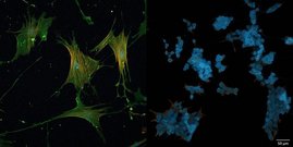 CD44 (grün) aktiviert krebsassoziierte Fibroblasten. Wird das Molekül ausgeschaltet (rechts), verändern die Zellen ihre Form und verlieren ihre Aktivierung.