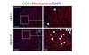 Immunfluoreszenzfärbung von CD31-positiven Kapillaren und Rhodamin-Färbung zur Abgrenzung der Kardiomyozyten im infarktgeschädigten Myokard