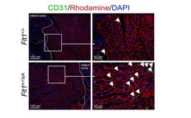 Immunfluoreszenzfärbung von CD31-positiven Kapillaren und Rhodamin-Färbung zur Abgrenzung der Kardiomyozyten im infarktgeschädigten Myokard Immunfluoreszenzfärbung von CD31-positiven Kapillaren und Rhodamin-Färbung zur Abgrenzung der Kardiomyozyten im infarktgeschädigten Myokard