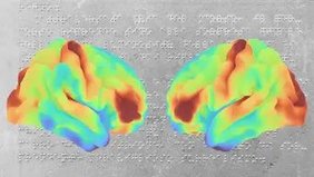Mikrostruktur des Gehirns blinder Menschen Mikrostruktur des Gehirns blinder Menschen