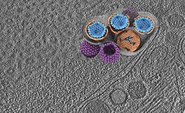 Kryo-Elektronentomogramm Herpesvirus in lebender Zelle  