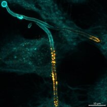 Der Pilz Candida albicans dringt in eine menschliche Epithelzelle ein und produziert das Toxin Candidalysin