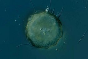 Schalenamöbe der Gattung Arcella