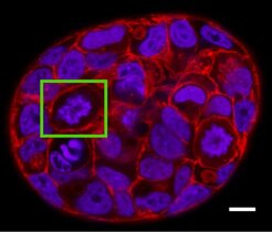 Ein Mini-Tumor aus menschlichen Brustkrebszellen (MCF-7). Grün: eine sich teilende Zelle.  
