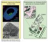 Oben abgebildet ist die Immunfluoreszenzfärbung von Ceramid (Membran), DAPI (DNA) und Phalloidin (F-Aktin), unten ist eine Transmissionselektronenmikroskopische Aufnahme (TEM) zu sehen. Oben abgebildet ist die Immunfluoreszenzfärbung von Ceramid (Membran), DAPI (DNA) und Phalloidin (F-Aktin), unten ist eine Transmissionselektronenmikroskopische Aufnahme (TEM) zu sehen.