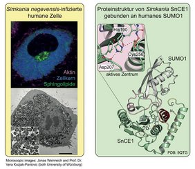 Oben abgebildet ist die Immunfluoreszenzfärbung von Ceramid (Membran), DAPI (DNA) und Phalloidin (F-Aktin), unten ist eine Transmissionselektronenmikroskopische Aufnahme (TEM) zu sehen. 