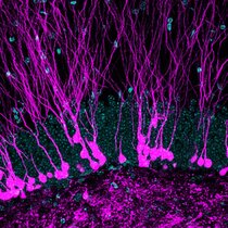 Vertikal verlaufende neue Neuronen (magenta) im Hippocampus einer erwachsenen Maus. Zellkerne sind cyan gefärbt.