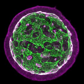 Architektur der neuroepithelialen Organoide 