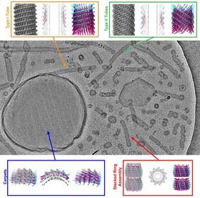 Kryo-EM zeigt verschiedene Vipp1-Strukturen