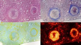 Granulomstruktur und Verteilung des Antibiotikums BTZ-043 in unterschiedlich gefärbten Gewebeschnitten