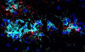 Ein neuer Ansatz gegen Alzheimer: Die Stimulation von Mikroglia durch einen Antikörper. Die Abbildung zeigt auf diese Weise stimulierte Mikroglia (cyan), die sich um Ablagerungen von Proteinen – sogenannte Plaques (rot) - sammeln und diese abbauen