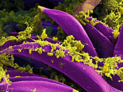 Yersinia pestis unter dem Rasterelektronenmiskroskop