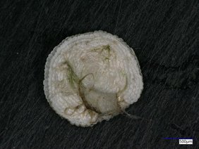 Die abgebildete Foraminifere wurde in einer Sedimentprobe des Umluj-Salzsees gefunden
