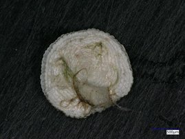 Die abgebildete Foraminifere wurde in einer Sedimentprobe des Umluj-Salzsees gefunden