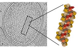 Anammox-Bakterium im Elektronenmikroskop