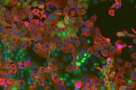 Zellkultur mit untrschiedlichen Färbungen