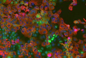 Zellkultur mit untrschiedlichen Färbungen