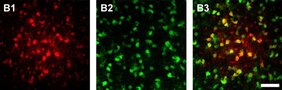 Wird ein Astrozyt im Thalamus mit Farbstoff gefüllt, diffundiert dieser in benachbarte Zellen des Netzwerks