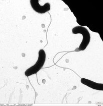 Mikroskopaufnahme von Cholera-Bakterien.