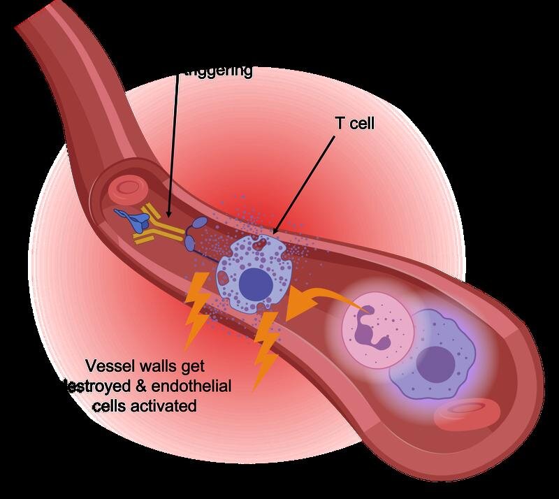The fatal role of T cells in COVID-19: VBIO
