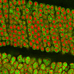 Schnitt durch die Netzhaut. Stäbchenzellen mit invertierten Kernen ("Mikrolinsen") im oberen Bildbereich, andere Netzhautneuronen mit konventionellen Kernen unten. 