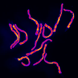 Die mitochondriale Stressreaktion in C. elegans kann mithilfe des grün fluoreszierenden Proteins (GFP) beobachtet werden. Das GFP-Signal wird hier in Falschfarben dargestellt. 