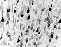 Das Bild zeigt die neuprogrammierten Neuronen in verschiedenen Grauschattierungen.