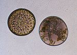 Gesunde (links) und infizierte (rechts) Kieselalge Coscinodiscus granii: Der parasitische Eipilz Lagenisma coscinodisci hat in der rechten Zelle alle Nährstoffe ausgesaugt und das Algenmetabolom moduliert, um seine eigene Fortpflanzungsform, das Sporangium, zu bilden.