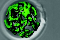 Netzwerkartige Struktur von grün eingefärbten Mitochondrien aus dem Modellorganismus der Bäckerhefe.