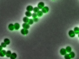 Daptomycin bindet an spezielle Bereiche der Zellhülle des Bakteriums Staphylococcus aureus, die reich an Angriffsstrukturen sind. Grün leuchtet das fluoreszenzmarkierte Daptomycin. Dies sind die Bereiche, wo sich die Zellen gerade teilen