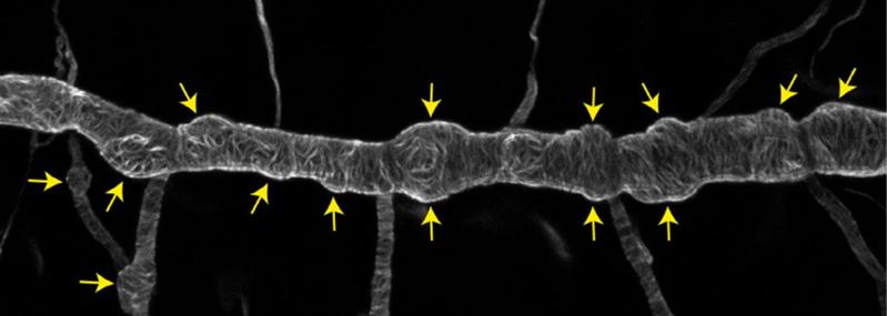 Lichtmikroskopische Aufnahme des Atemorgans eines Drosophila Embryos. Die gelben Pfeile zeigen auf ungewöhnliche Ausbeulungen eines eigentlich glatten röhrenförmigen Tracheenastes.