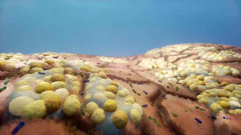 Eine Mikrobengemeinschaft auf dem menschlichen Körper. Gruppen von Staphylokokken in Sekret und andere Hautmikroben.