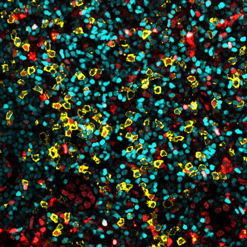 Eine Aufnahme von Immunzellen in einem Lymphknoten. Ansässige Zellen sind rot, zirkulierende in cyan markiert