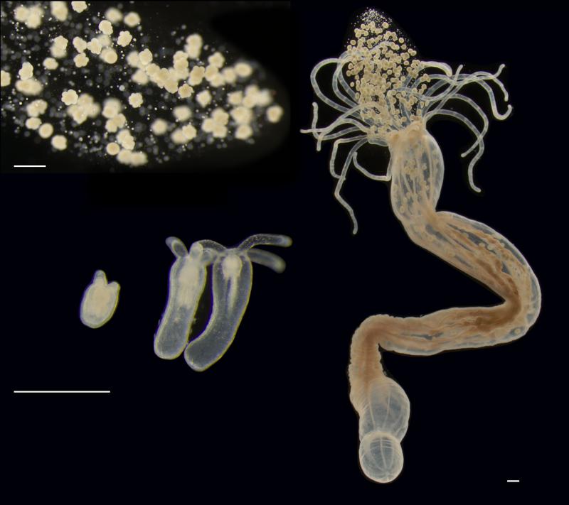 Verschiedene Lebensstadien der Seeanemone Nematostella vectenis. Oben links die Eier, Mitte links verschiedene Wachstumsstadien, rechts das erwachsene Tier