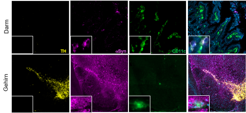 Mikroskopische Aufnahmen von Zellen im Darm (oben) und Gehirn (unten) einer Maus mit Parkinson