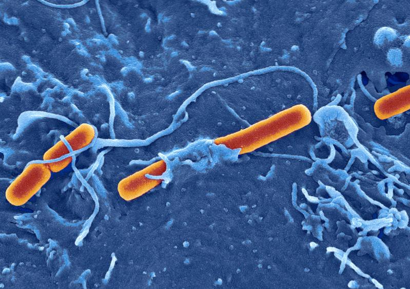 Das Bakterium Shigella flexneri, hier beim Eindringen in eine embryonische Stammzelle.  