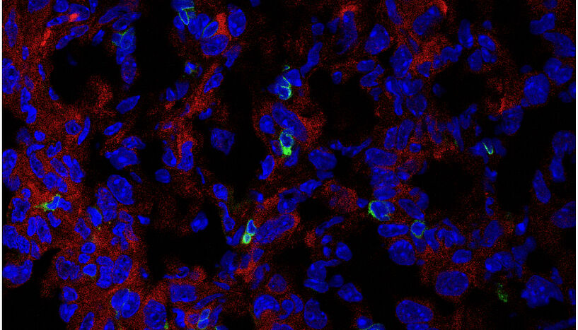  Immunfluoreszenzbild der Expression von PHGDH (rot) und CD3-T-Zellen (grün) im kryogeschnittenen AE17-Mesotheliom.