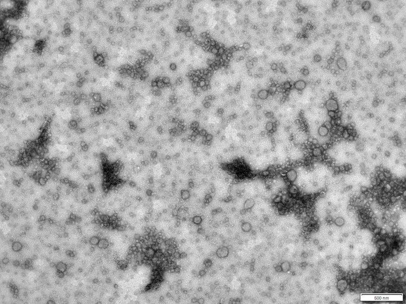 Extrazelluläre Vesikel des Haloarchaeon Haloferax volcanii, sichtbar gemacht mit einem Elektronenmikroskop. 