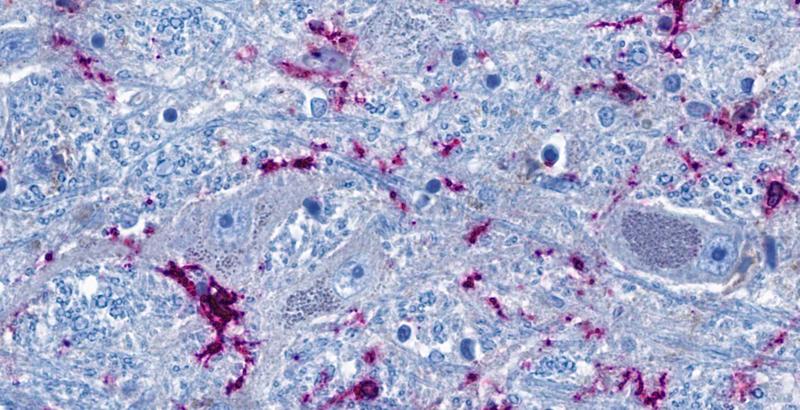Ausschnitt aus dem Hirnstamm: Nervenzellen (graublau) stehen eng mit hirneigenen Immunzellen (lila) in Kontakt.